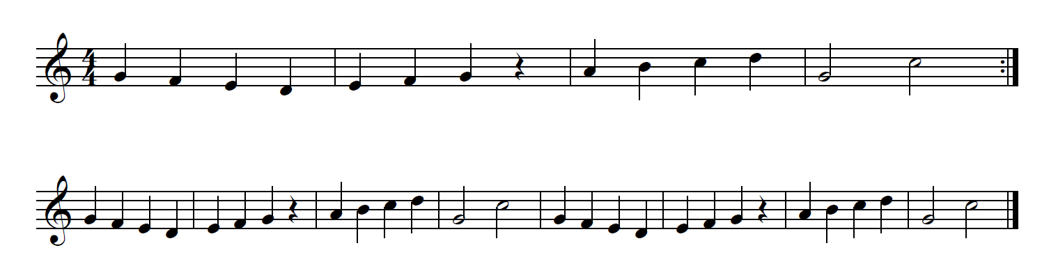 signos de repetición cuáles son los signos de repetición